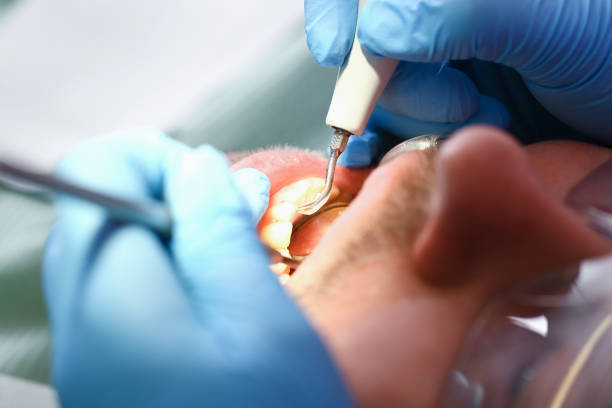 Best Pediatric Emergency Dentist in Maple Heights Lake Desire, WA